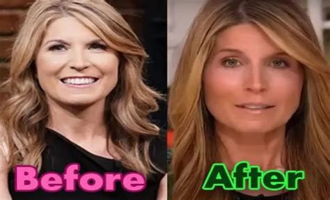 MSNBC Nicolle Wallace Tests Positive for Coronavirus By A. . Nicolle wallace teeth